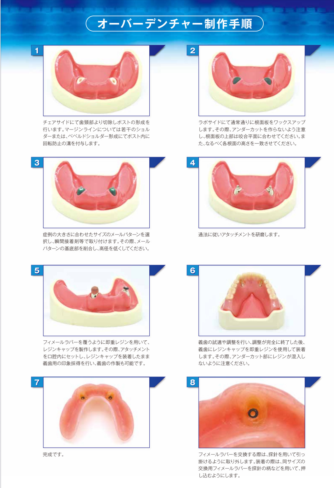 一般歯科